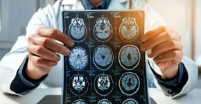 Foto: (iStock/Makhbubakhon Ismatova)