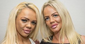 Mãe e filha viciadas em cirurgias plásticas ganham reality show na TV britânica
