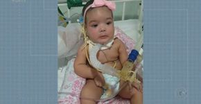 Hospital usa crianças com doenças raras em campanha solidária