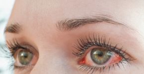 Foto: (iSTock/Tunatura)