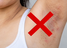 Featured side: Como suavizar manchas nas axilas e virilhas sem cair em receitas que podem irritar a pele