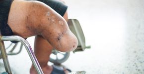 Foto: (iSTock)