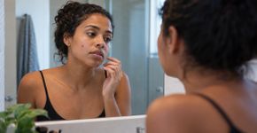 Dermatologistas alertam que espremer espinhas pode empurrar a inflamação para camadas mais profundas e aumentar o risco de manchas e cicatrizes