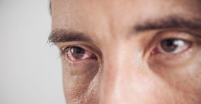 Foto: (Dragonvanish/istock)