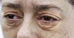 Foto: (fotocelia/istock)