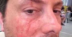 Catraca e Quebrando o Tabu apoiam campanha de Danilo Gentili