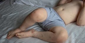 Foto: (Margarita-Young/istock)
