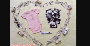 Mulher mostra fotos emocionantes de processo de fertilização