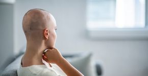 Remédio para artrite faz cabelo de pacientes com alopecia crescer
