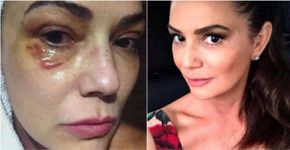 Luiza Brunet posta foto antiga e manda mensagem feminista