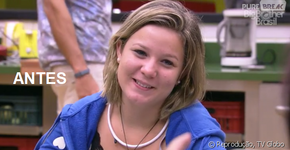Ex BBB Cacau mostra resultados do preenchimento labial e do botox