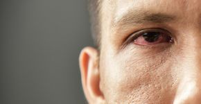Foto: (eggeeggjiew/istock)