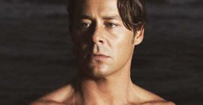 Theo Becker impressiona por magreza excessiva na web