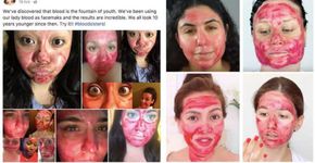 Máscara facial com sangue menstrual: entenda essa vibe
