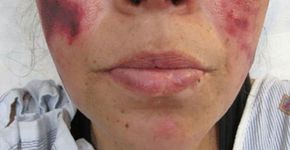 Foto: (reprodução/BMJ Case Reports)