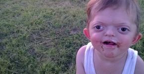 Mãe luta para banir da internet memes com fotos de filho com síndrome rara