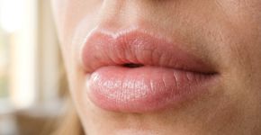 Como deixar os lábios com aparência mais rosada naturalmente: 3 cuidados caseiros com cúrcuma, mel e beterraba que podem substituir o batom na rotina