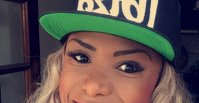 Ex-BBB Adélia mostra antes e depois de cirurgia para diminuir as bochechas