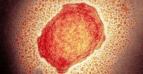 Foto: (Science Photo Library)