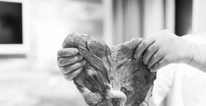 11 fotos de nascimento que valorizam a placenta