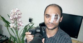 Justiça nega novamente indenização a fotógrafo que perdeu o olho