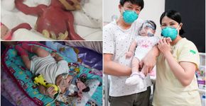 Foto: (National University Hospital)