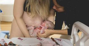Parto natural: mãe dá à luz gêmeos com sete horas de intervalo