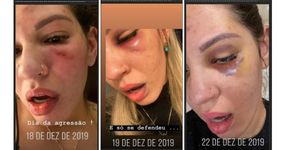 Foto: (Reprodução/Instagram Stories)