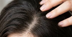 Adeus, caspa: deixar o xampu anticaspa agir de 5 a 10 minutos antes de enxaguar muda o resultado, segundo dermatologistas