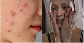 Foto: (iStock | kobzev3179 | aywan88)