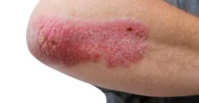 Foto: (JodiJacobson/istock)