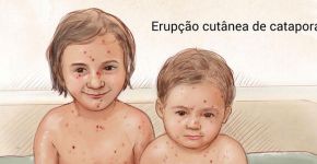Google cria quadros com informações sobre doenças