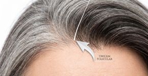 A ciência investiga a origem dos cabelos grisalhos e descobre que os fios brancos são um mecanismo vital para proteção dos cabelos