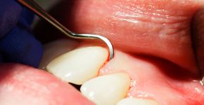 Foto: (RichLegg/istock)