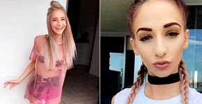 Modelo com anorexia revela ataques e faz apelo contra bullying