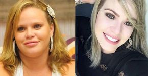 Efeito BBB faz mulheres cobaias estéticas e ficam irreconhecíveis
