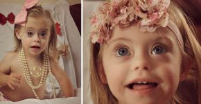 Menina de 2 anos com Down assina contrato como modelo
