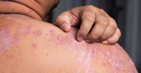 Foto: (Ranee Sornprasitt/iStock)