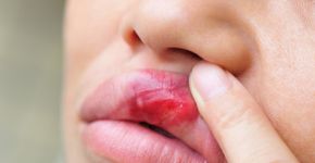Foto: (lzf/istock)
