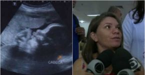 Médicos acreditam que bebê baleado pode ter salvado a vida da mãe
