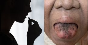 Foto: (kieferpix/istock/BMJ Journals)