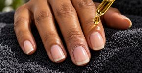 Óleo de cutícula ajuda a reduzir o aspecto ressecado ao redor das unhas, mas não substitui cuidado quando há dor ou inflamação
