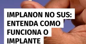 Implanon será oferecido pelo SUS: veja como funciona o anticoncepcional gratuito