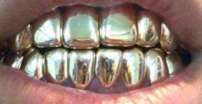 Com R$ 157 mil, Marco Feliciano teria todos seus dentes de ouro