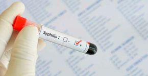 Brasil enfrenta epidemia de sífilis: saiba como se proteger