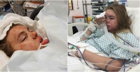 Mãe publica alerta após filha entrar em coma por causa de ecstasy