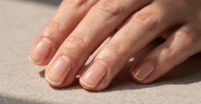 Adeus, unhas amareladas: 5 dicas para mãos com aparência limpa e natural