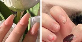 Esta garota compartilhou a realidade sobre usar unhas de acrílico
