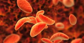 Foto: (Dr_Microbe/istock)