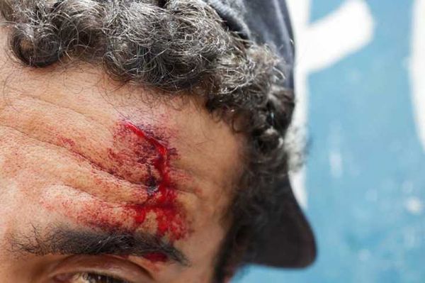 As agressões aos moradores da cracolândia são frequentes